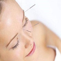 Facial Rejuvenation Acupuncture In Montreal 30 Years Of Experience